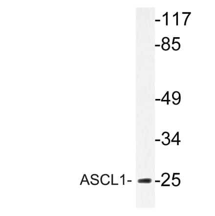 Western Blot - Anti-ASCL1 Antibody (R12-2031) - Antibodies.com