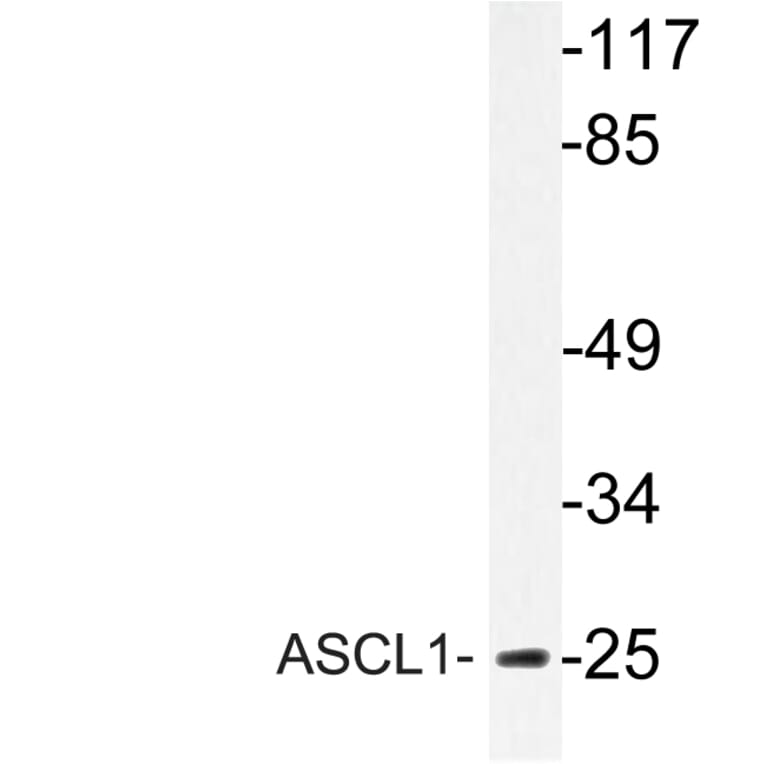 Western Blot - Anti-ASCL1 Antibody (R12-2031) - Antibodies.com