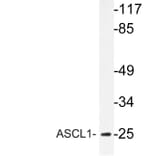 Western Blot - Anti-ASCL1 Antibody (R12-2031) - Antibodies.com