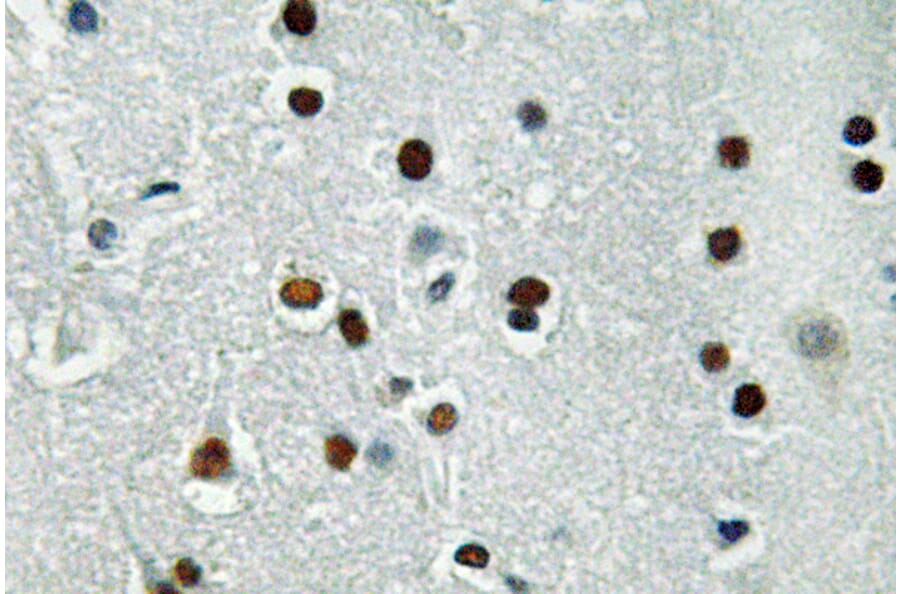 IHC - Anti-ASCL1 Antibody (A95934)