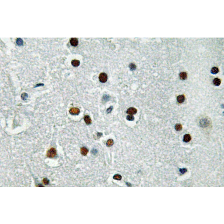 Immunohistochemistry - Anti-ASCL1 Antibody (R12-2031) - Antibodies.com