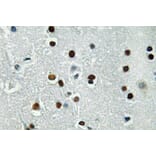 Immunohistochemistry - Anti-ASCL1 Antibody (R12-2031) - Antibodies.com
