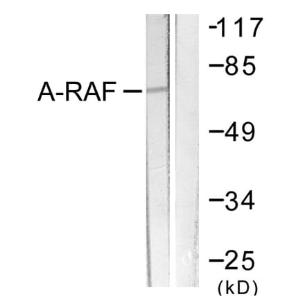 Western Blot - Anti-A-RAF Antibody (B0770) - Antibodies.com