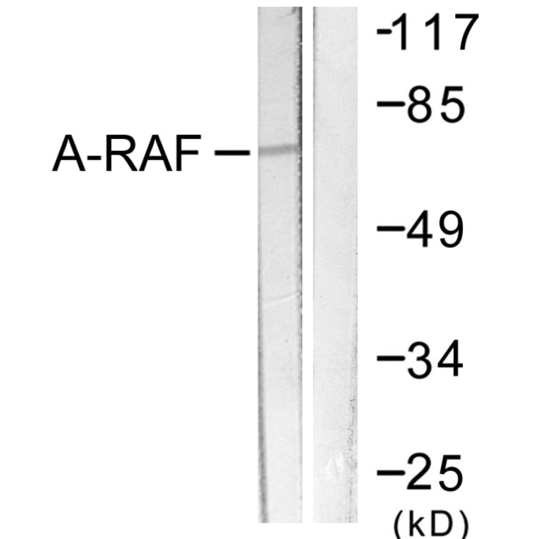 Western Blot - Anti-A-RAF Antibody (B0770) - Antibodies.com