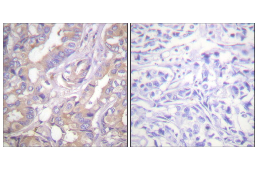 Immunohistochemistry - Anti-A-RAF Antibody (B0770) - Antibodies.com