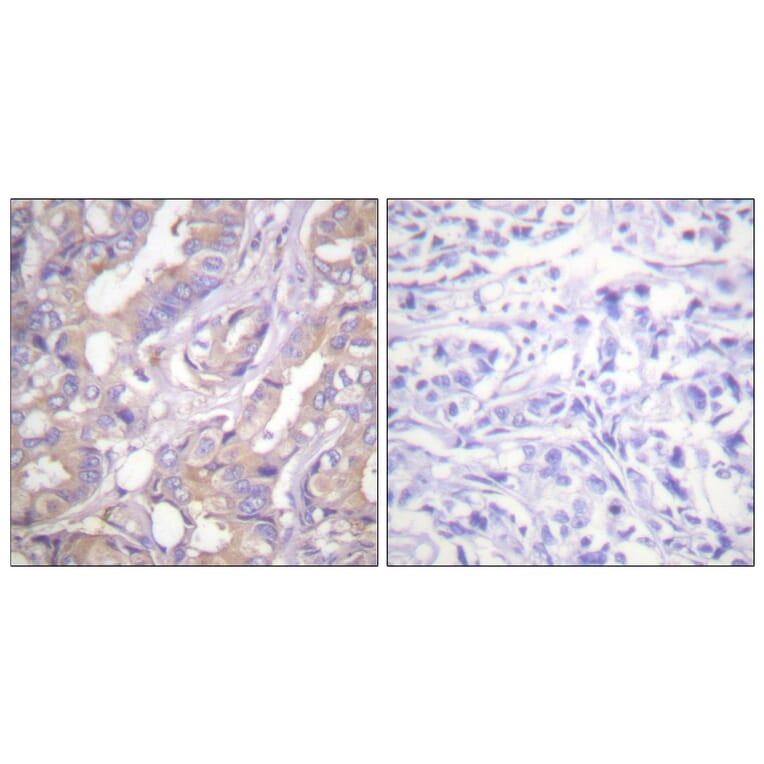 Immunohistochemistry - Anti-A-RAF Antibody (B0770) - Antibodies.com