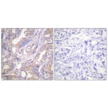 Immunohistochemistry - Anti-A-RAF Antibody (B0770) - Antibodies.com