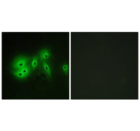 Immunofluorescence - Anti-ADCY8 Antibody (C12038) - Antibodies.com