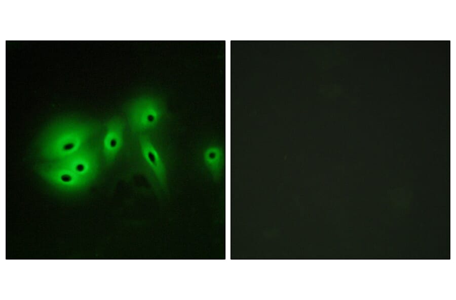 Immunofluorescence - Anti-ADCY8 Antibody (C12038) - Antibodies.com