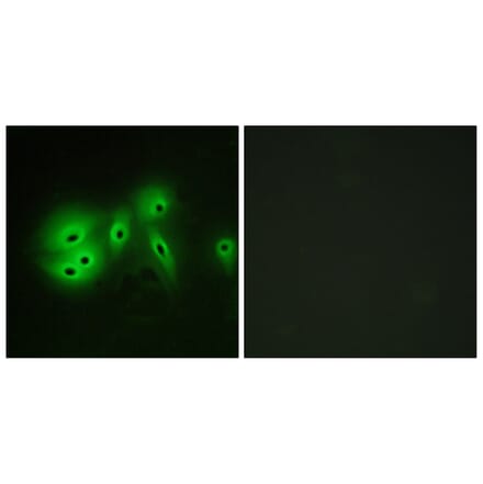 Immunofluorescence - Anti-ADCY8 Antibody (C12038) - Antibodies.com