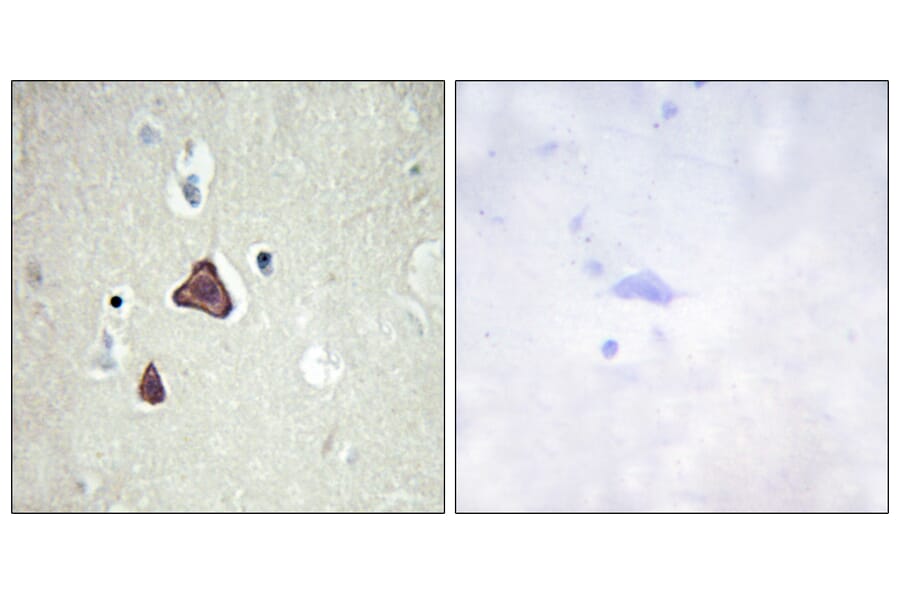 Immunohistochemistry - Anti-ADCY8 Antibody (C12038) - Antibodies.com