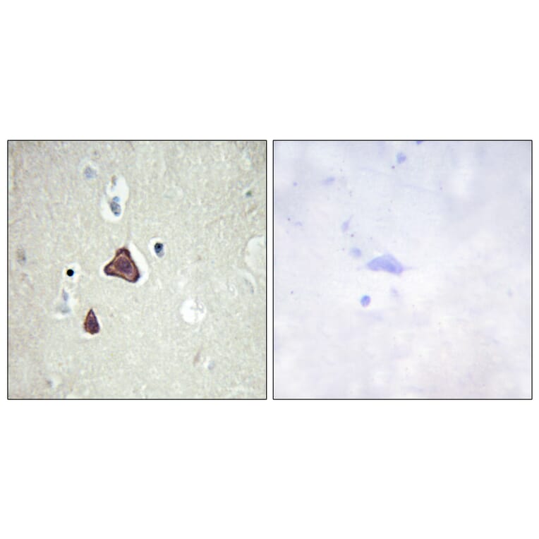 Immunohistochemistry - Anti-ADCY8 Antibody (C12038) - Antibodies.com