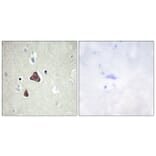 Immunohistochemistry - Anti-ADCY8 Antibody (C12038) - Antibodies.com