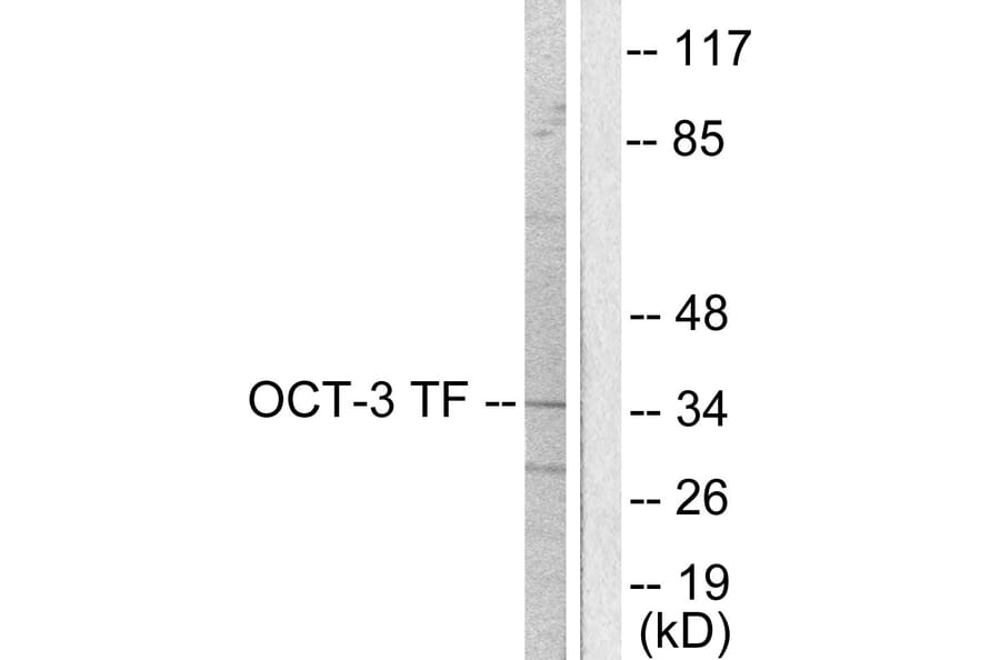 Western Blot - Anti-OCT3 Antibody (C0283) - Antibodies.com
