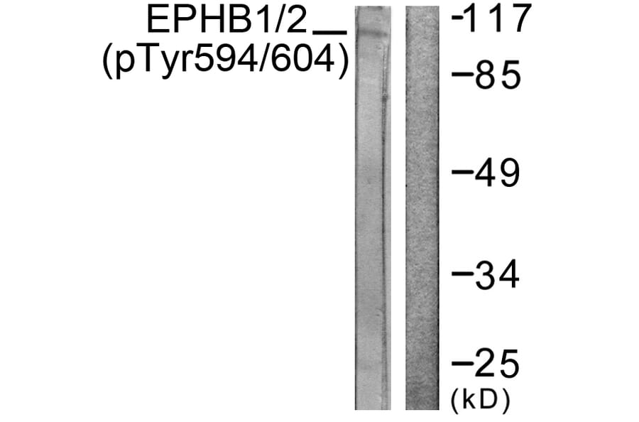 Western Blot - Anti-EPHB1 + EPHB2 (phospho Tyr594 + Tyr604) Antibody (A0915) - Antibodies.com