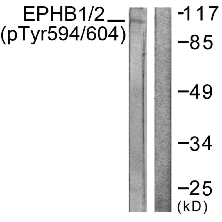 Western Blot - Anti-EPHB1 + EPHB2 (phospho Tyr594 + Tyr604) Antibody (A0915) - Antibodies.com