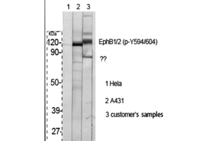 Western Blot - Anti-EPHB1 + EPHB2 (phospho Tyr594 + Tyr604) Antibody (A0915) - Antibodies.com