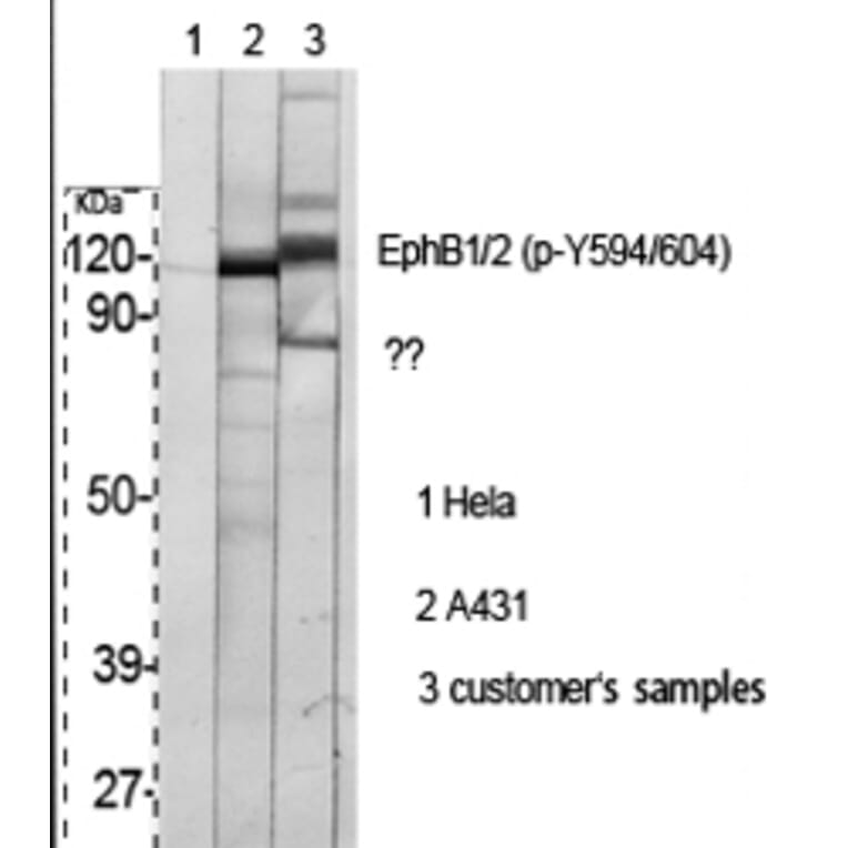 Western Blot - Anti-EPHB1 + EPHB2 (phospho Tyr594 + Tyr604) Antibody (A0915) - Antibodies.com