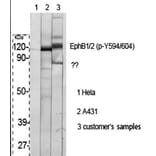 Western Blot - Anti-EPHB1 + EPHB2 (phospho Tyr594 + Tyr604) Antibody (A0915) - Antibodies.com