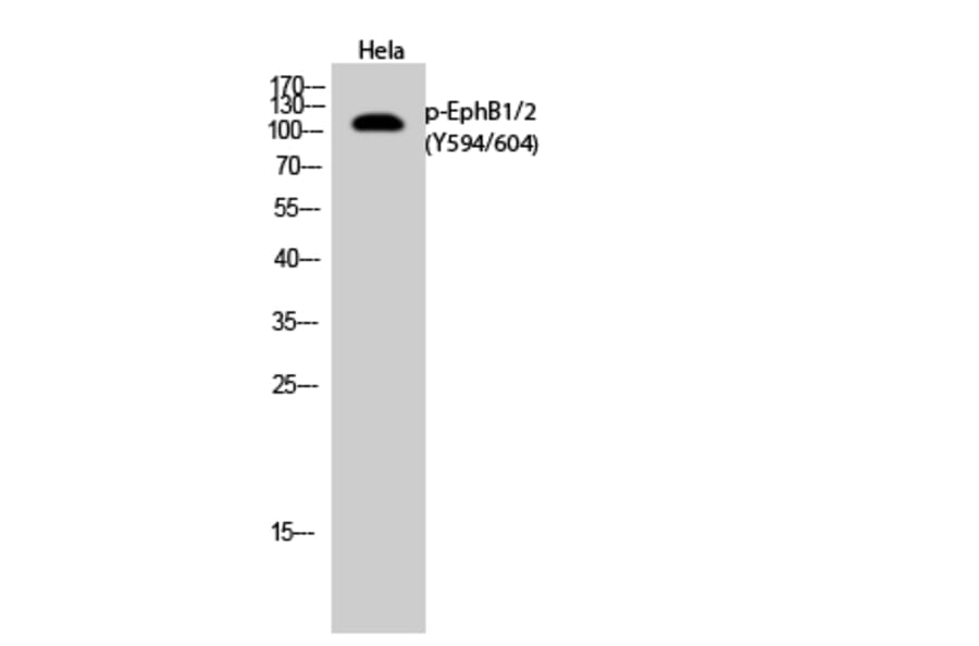 Western Blot - Anti-EPHB1 + EPHB2 (phospho Tyr594 + Tyr604) Antibody (A0915) - Antibodies.com