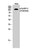 Western Blot - Anti-EPHB1 + EPHB2 (phospho Tyr594 + Tyr604) Antibody (A0915) - Antibodies.com