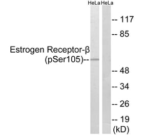 Western Blot - Anti-Estrogen Receptor-beta (phospho Ser105) Antibody (A0922) - Antibodies.com