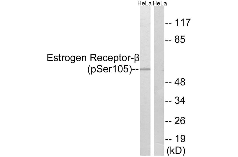 Western Blot - Anti-Estrogen Receptor-beta (phospho Ser105) Antibody (A0922) - Antibodies.com