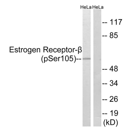 Western Blot - Anti-Estrogen Receptor-beta (phospho Ser105) Antibody (A0922) - Antibodies.com