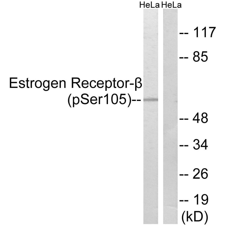 Western Blot - Anti-Estrogen Receptor-beta (phospho Ser105) Antibody (A0922) - Antibodies.com