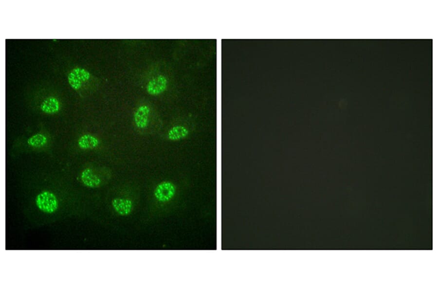 Immunofluorescence - Anti-Estrogen Receptor-beta (phospho Ser105) Antibody (A0922) - Antibodies.com
