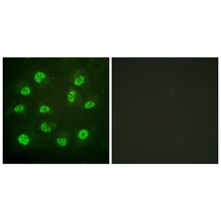 Immunofluorescence - Anti-Estrogen Receptor-beta (phospho Ser105) Antibody (A0922) - Antibodies.com