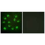Immunofluorescence - Anti-Estrogen Receptor-beta (phospho Ser105) Antibody (A0922) - Antibodies.com