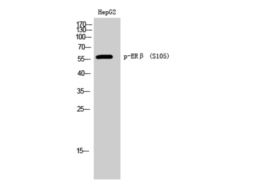 Western Blot - Anti-Estrogen Receptor-beta (phospho Ser105) Antibody (A0922) - Antibodies.com