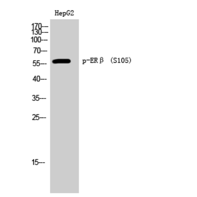 Western Blot - Anti-Estrogen Receptor-beta (phospho Ser105) Antibody (A0922) - Antibodies.com