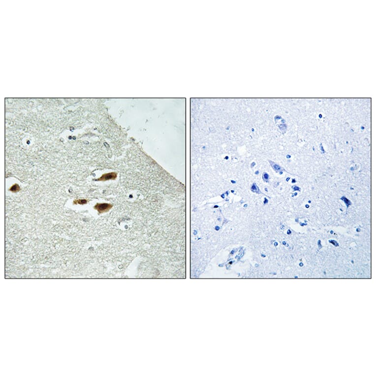 Immunohistochemistry - Anti-Period Circadian Protein 2 (phospho Ser662) Antibody (A1223) - Antibodies.com