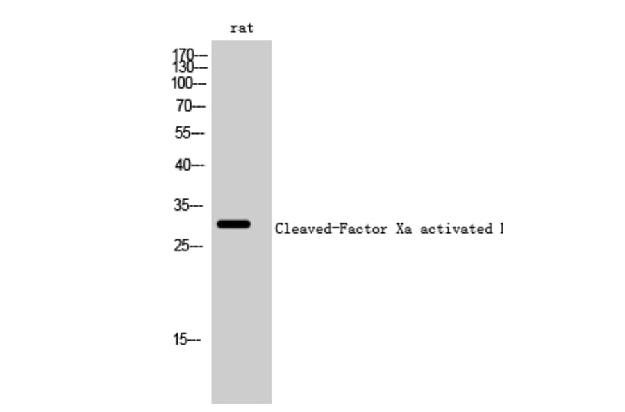Western Blot - Anti-FA10 (activated heavy chain,cleaved Ile235) Antibody (L0126) - Antibodies.com