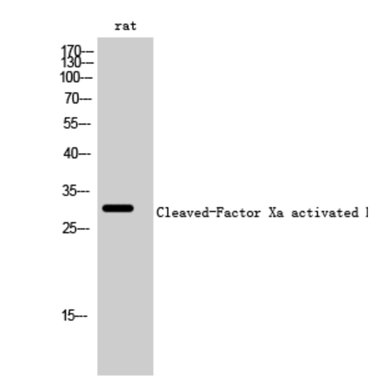 Western Blot - Anti-FA10 (activated heavy chain,cleaved Ile235) Antibody (L0126) - Antibodies.com