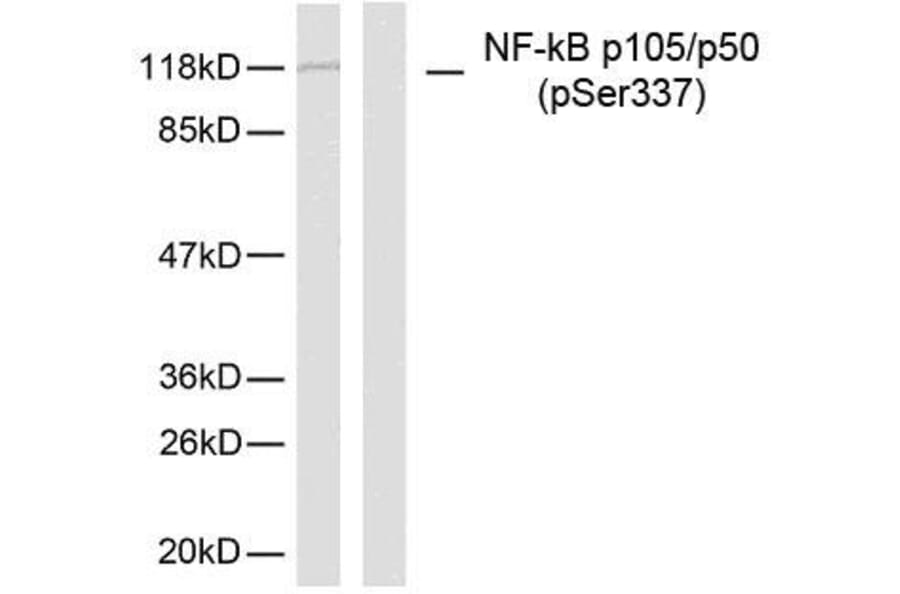 Western Blot - Anti-NF kappa B p105 / p50 (phospho Ser337) Antibody (A7166) - Antibodies.com