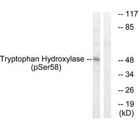 Western Blot - Anti-Tryptophan Hydroxylase (phospho Ser58) Antibody (A1011) - Antibodies.com