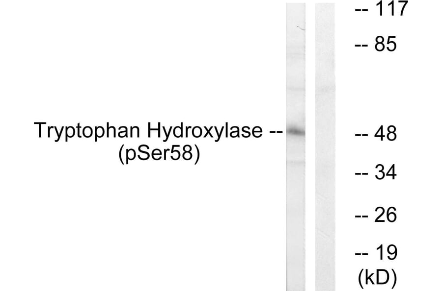Western Blot - Anti-Tryptophan Hydroxylase (phospho Ser58) Antibody (A1011) - Antibodies.com
