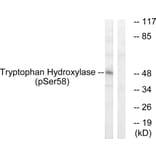 Western Blot - Anti-Tryptophan Hydroxylase (phospho Ser58) Antibody (A1011) - Antibodies.com
