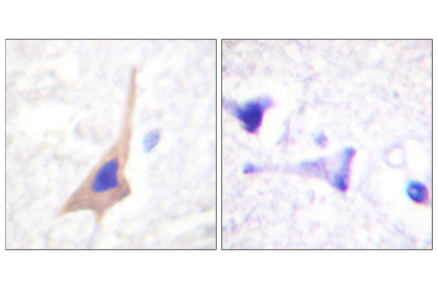 Immunohistochemistry - Anti-Tryptophan Hydroxylase (phospho Ser58) Antibody (A1011) - Antibodies.com