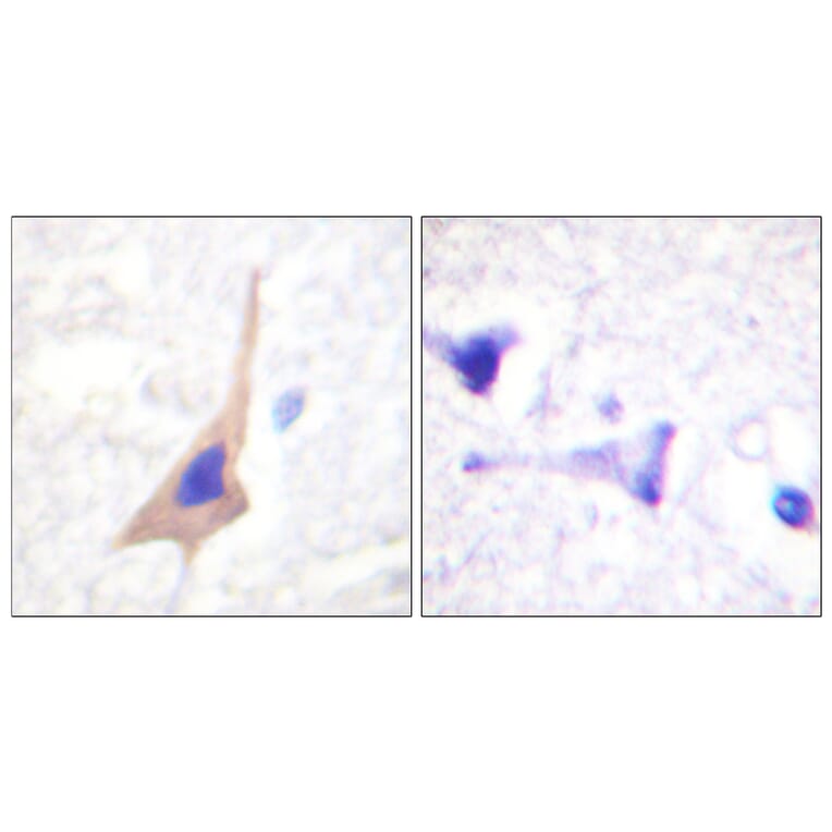Immunohistochemistry - Anti-Tryptophan Hydroxylase (phospho Ser58) Antibody (A1011) - Antibodies.com