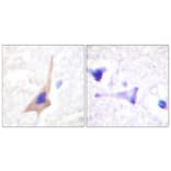 Immunohistochemistry - Anti-Tryptophan Hydroxylase (phospho Ser58) Antibody (A1011) - Antibodies.com