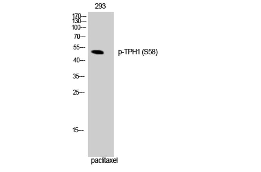 Western Blot - Anti-Tryptophan Hydroxylase (phospho Ser58) Antibody (A1011) - Antibodies.com