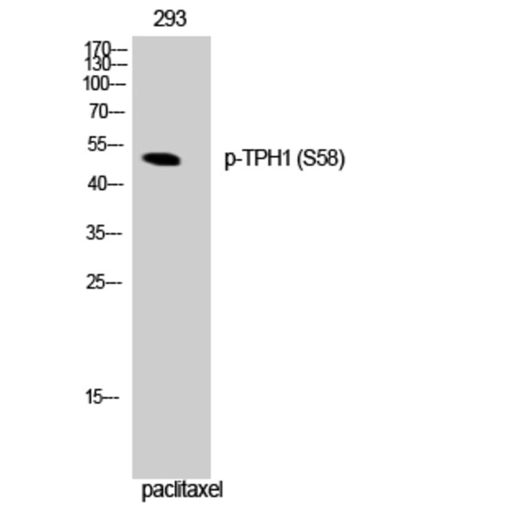 Western Blot - Anti-Tryptophan Hydroxylase (phospho Ser58) Antibody (A1011) - Antibodies.com