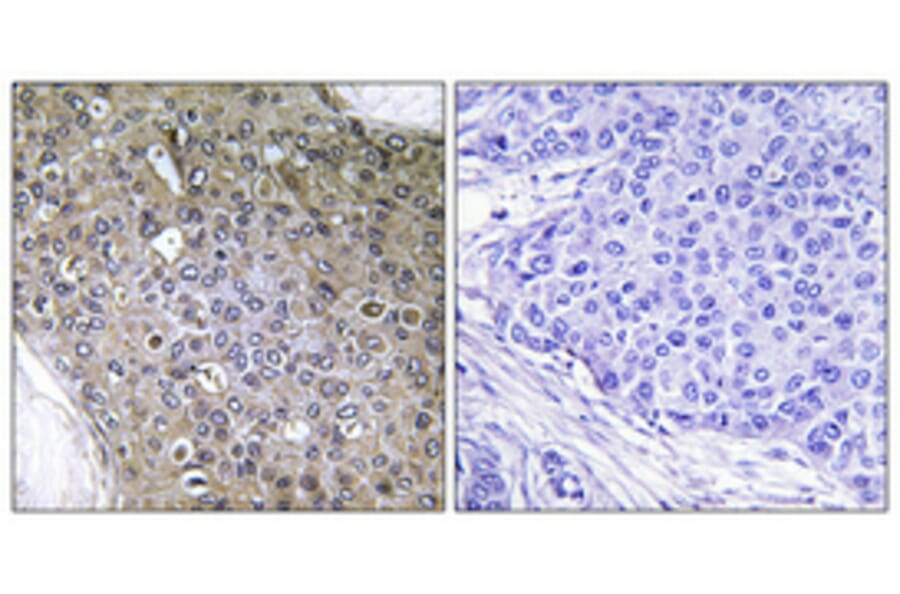Immunohistochemistry - Anti-TGF beta Receptor III (phospho Thr842) Antibody (A1128) - Antibodies.com