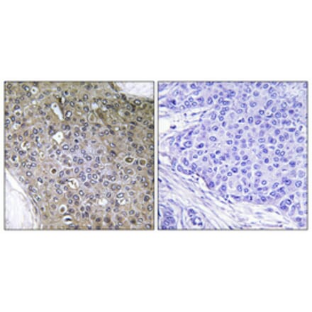 Immunohistochemistry - Anti-TGF beta Receptor III (phospho Thr842) Antibody (A1128) - Antibodies.com