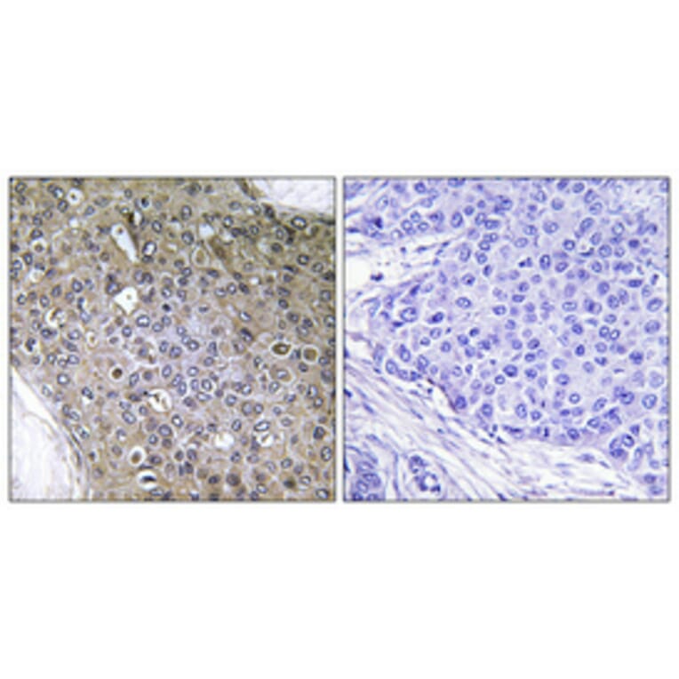 Immunohistochemistry - Anti-TGF beta Receptor III (phospho Thr842) Antibody (A1128) - Antibodies.com