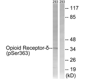 Western Blot - Anti-Opioid Receptor-delta (phospho Ser363) Antibody (A0420) - Antibodies.com